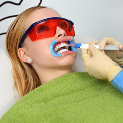Woman receiving professional teeth whitening treatment