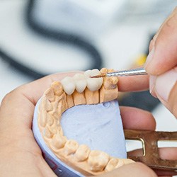 Closeup of dentist crafting dental bridge