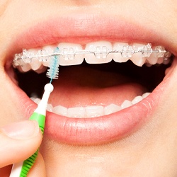 person flossing between the wires on their clear braces