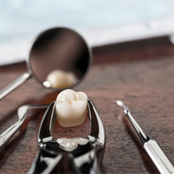 Smiling dental patient after tooth extractions