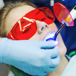 A person receiving tooth colored fillings