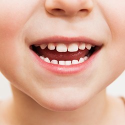 Young child's smile after fluoride treatment