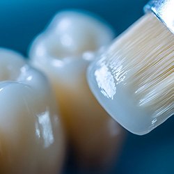 A brush applying a dental sealant to a back tooth