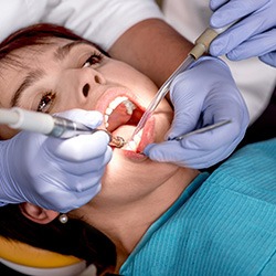 Patient receiving dental sealants during an appointment