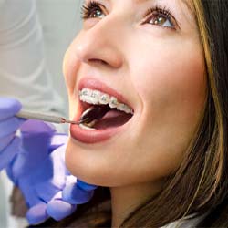 closeup of woman during orthodontic checkup in McKinney