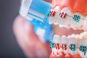 model of a mouth with braces brushing teeth