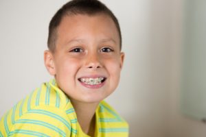 Young boy needing braces for children