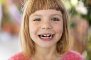 child wearing braces with baby teeth