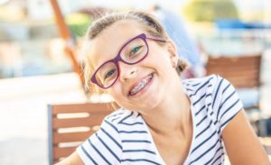 girl smiling with braces and some baby teeth