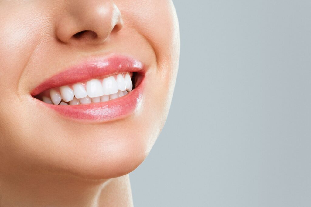 Nose-to-neck view of woman smiling with bright white teeth