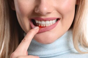 Woman with gum disease. 