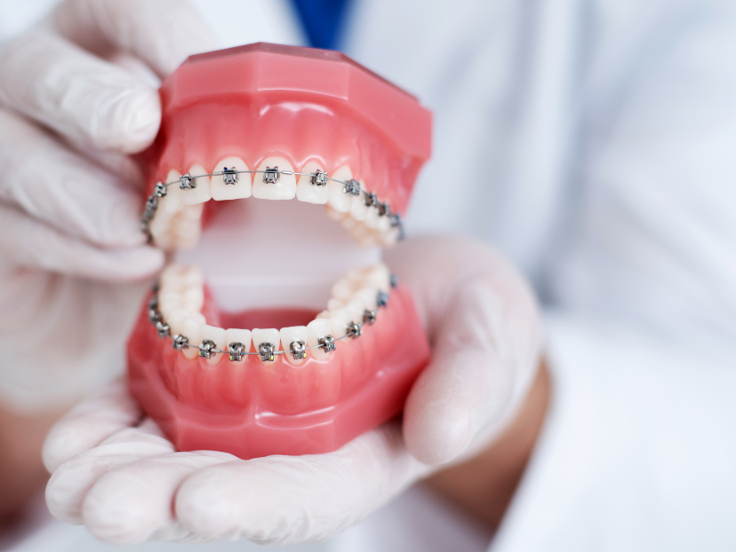 Dentist holding model mouth with braces